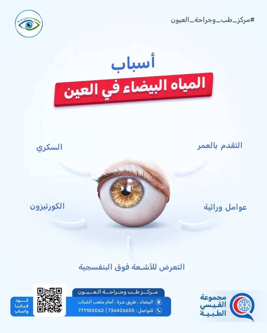 اسباب المياة البيضا۽ بالعين