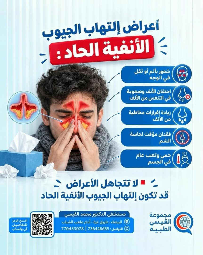 اعراض التهاب الجيوب الأنفية الحاد