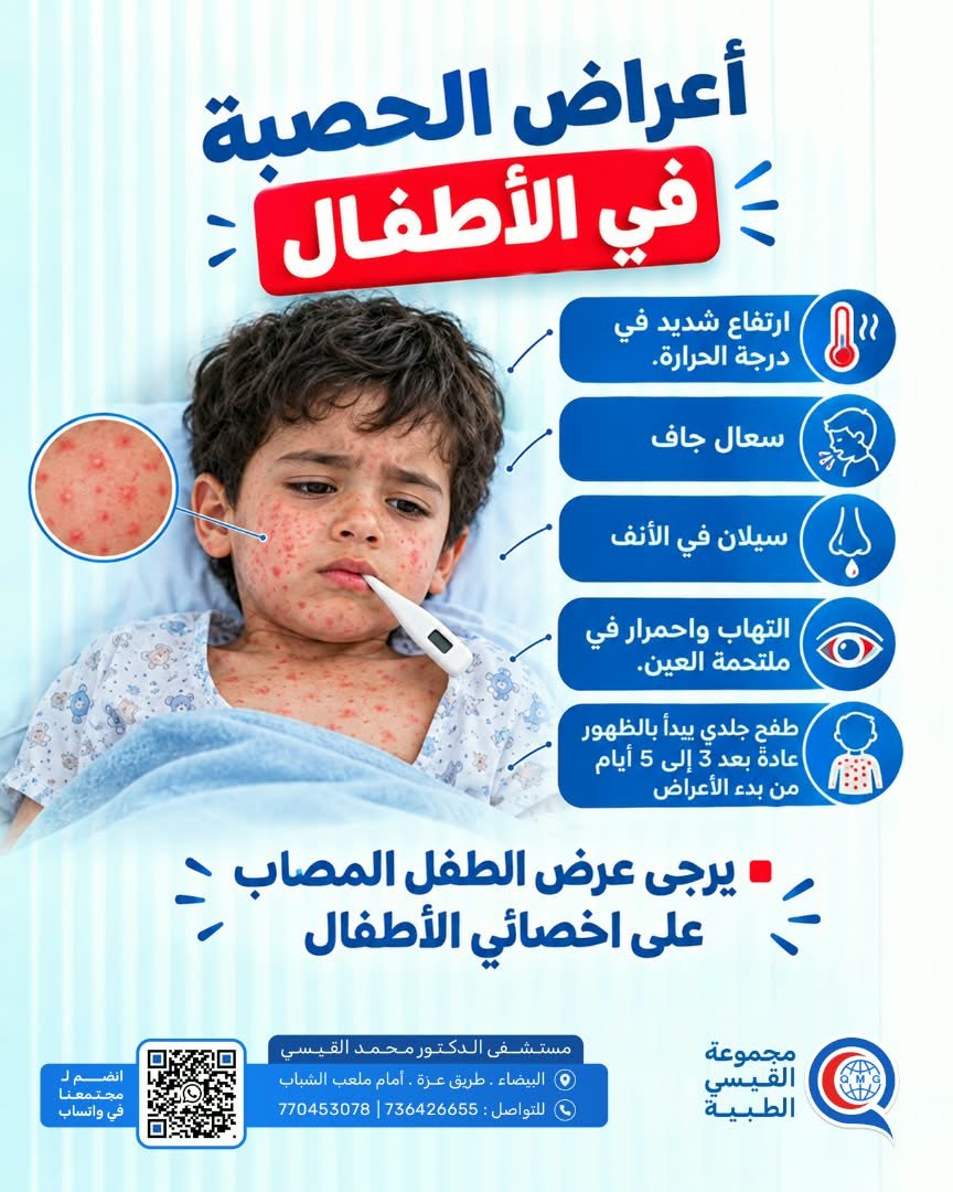 أعراض الحصبة في الأطفال