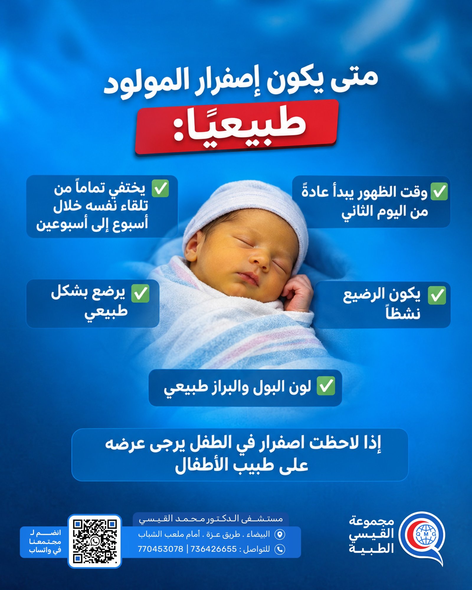 اصفرار الأطفال