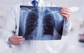 اشعة x جهة Xray-One Side